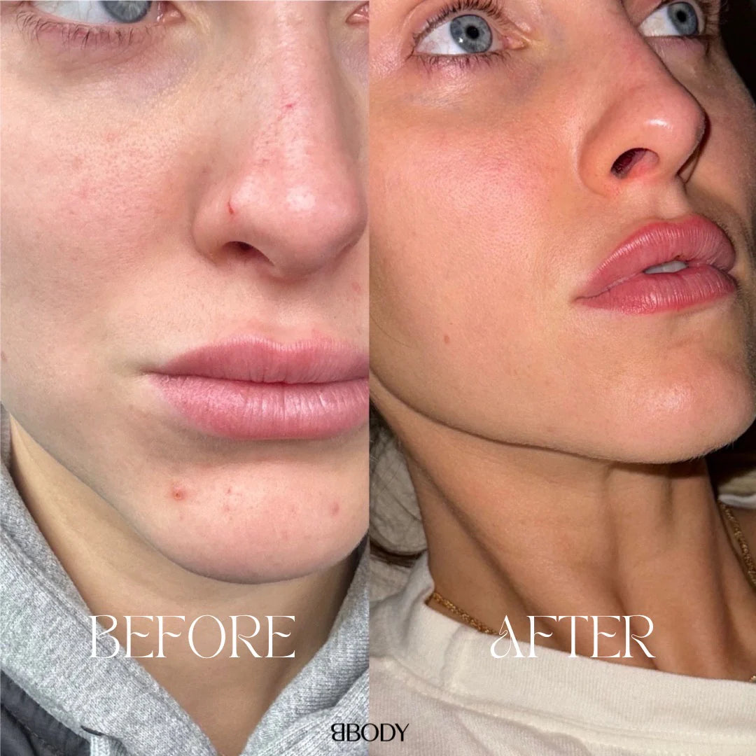 BBody Collageen + Vitamine C - 300 g